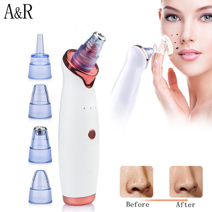 Blackhead Remover Vacuum Electric Nose Beauty Face Deep Cleansing Skin Care Vacuum  Black Spots Acne Pore Cleaner Pimple Tool